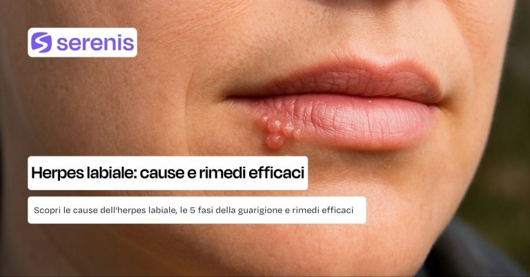 Herpes labiale: cause, rimedi efficaci e come velocizzare la guarigione