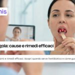 Placche in Gola: cause, rimedi efficaci e quando preoccuparsi