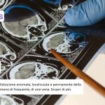 Aneurisma cos'è, cause e fattori di rischio