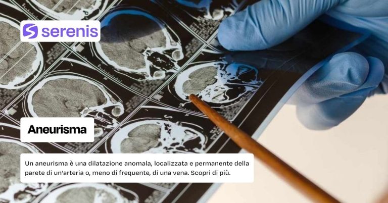 Aneurisma cos'è, cause e fattori di rischio