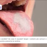 Candida cause e come curarla