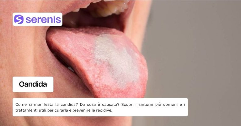 Candida cause e come curarla