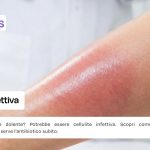 Cellulite infettiva cause e rimedi