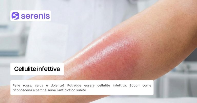 Cellulite infettiva cause e rimedi