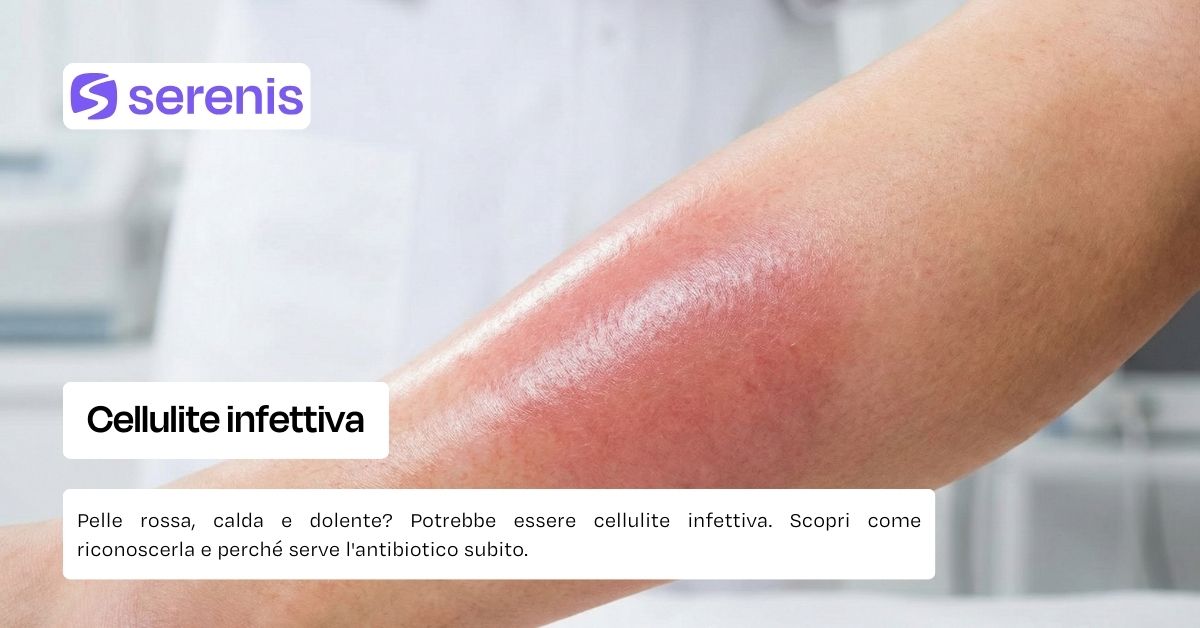 Cellulite infettiva: cos'è, sintomi e come curarla - Serenis Medicina
