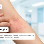 Dermatite allergica sintomi e come curarla