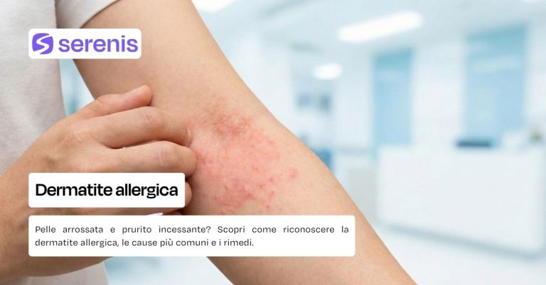 Dermatite allergica sintomi e come curarla