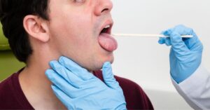 Diagnosi della mononucleosi: monotest