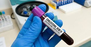 Esami colesterolo LDL alti