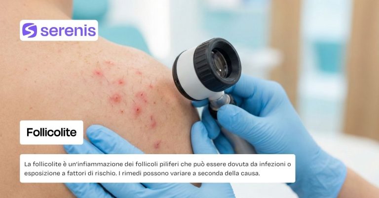 Follicolite cause e rimedi