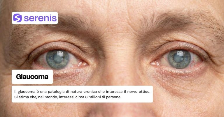 Glaucoma che cos'è e quali sono le cause