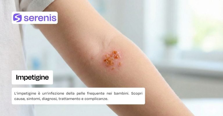 Impetigine cause sintomi rimedi