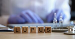 Le diverse forme di lupus eritematoso sistemico