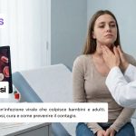 Mononucleosi cause, sintomi e come si trasmette