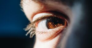 Rappresentazione della Sindrome di Sjögren