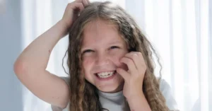 Varicella bambini