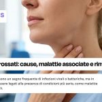 linfonodi-ingrossati-collo