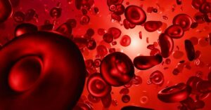 talassemia