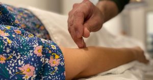 Agopuntura cosa cura