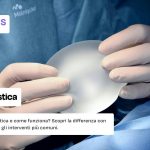 Chirurgia plastica cos'è