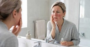 Come riconoscere la rosacea