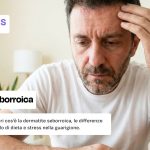 Dermatite seborroica