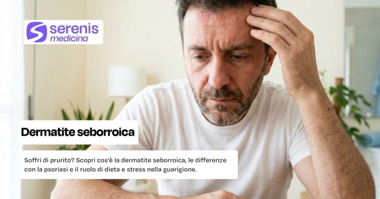 Dermatite seborroica