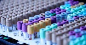 Esami del sangue prolattina alta