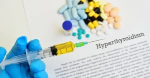 Ipertiroidismo diagnosi e cure