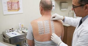 Patch test a cosa serve