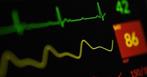 Quando preoccuparsi per la tachicardia