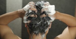 dermatite seborroica shampoo