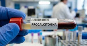 Esame procalcitonina valori normali