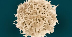 Leucociti alti quando preoccuparsi