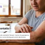 Orticaria da contatto immagini