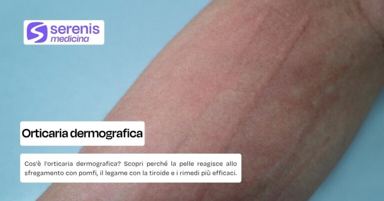 Orticaria dermografica