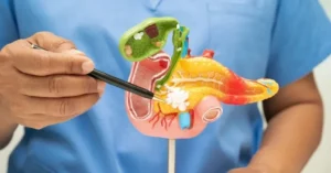 Pancreatite cos'è