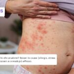 Pomfi come riconoscere le cause