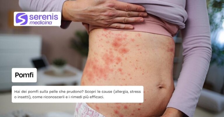 Pomfi come riconoscere le cause