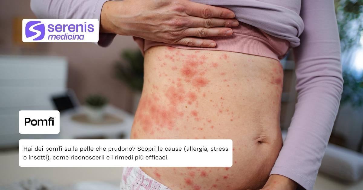 Pomfi e prurito improvviso: cause, rimedi e quando preoccuparsi