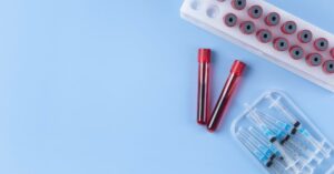 Quanto dura una ricetta per gli esami del sangue