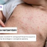 Sesta malattia nei bambini
