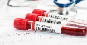 esame Creatinchinasi