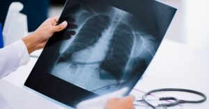 esami diagnostici strumentali o di imaging