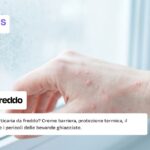 orticaria-da-freddo-sintomi-mano