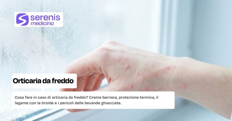orticaria-da-freddo-sintomi-mano
