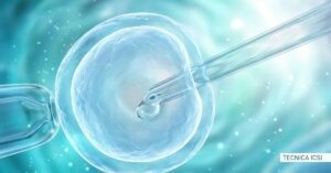 Fecondazione in vitro