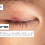 Cause dell'orzaiolo nei bambini