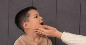 Come riconoscere l'herpes nei bambini