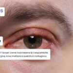 Cosa fare per la congiuntivite